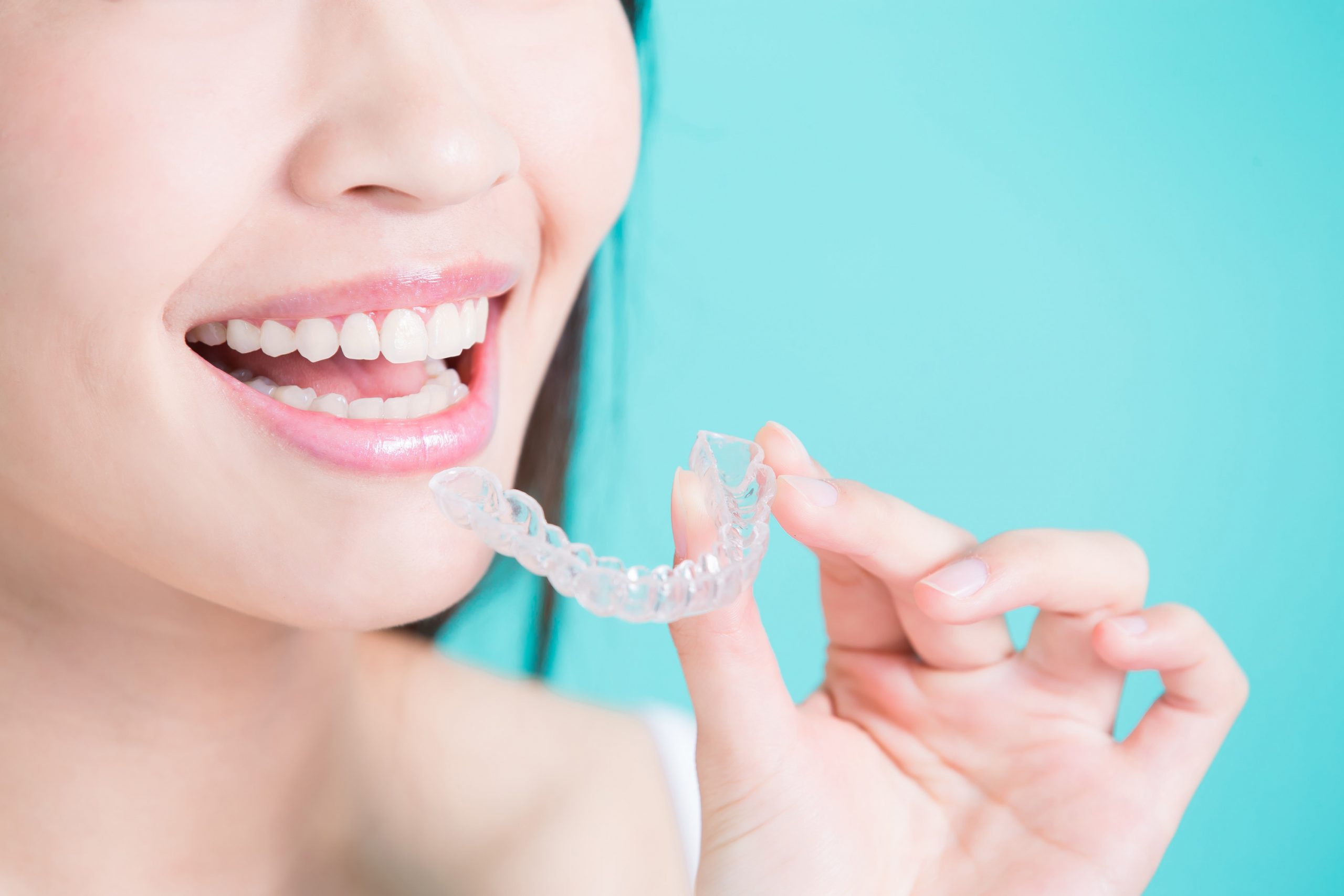 Advantages Of Invisalign 1 Scaled